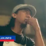 Yukie PasBand Kecelakaan di Arcamanik Bandung Luka 10 Jahitan