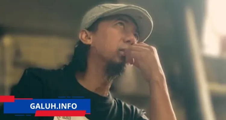 Yukie PasBand Kecelakaan di Arcamanik Bandung Luka 10 Jahitan
