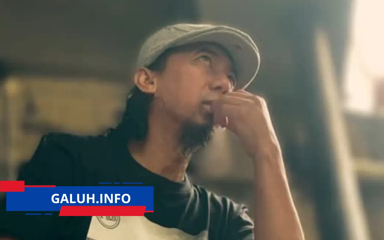 Yukie PasBand Kecelakaan di Arcamanik Bandung Luka 10 Jahitan